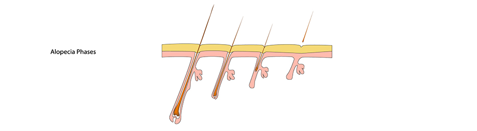 alopecia hair growth phases