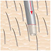 harvesting follicular units grafts